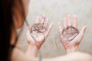 Mevsimsel saç dökülmesi - Saç Kaybı - Saç Dökülmesi Tedavisi Ankara