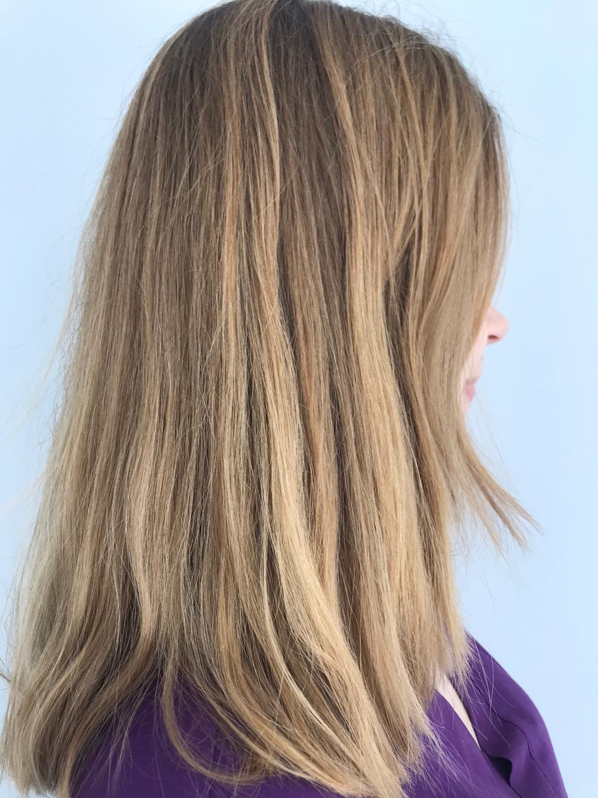 Kadınlarda Saç Dökülmesi Tedavisi | Doç. Dr. Ekrem Civas | Ankara