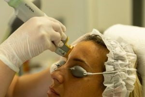Skin rejuvenation, Ankara skin rejuvenation, Laser skin resurfacing