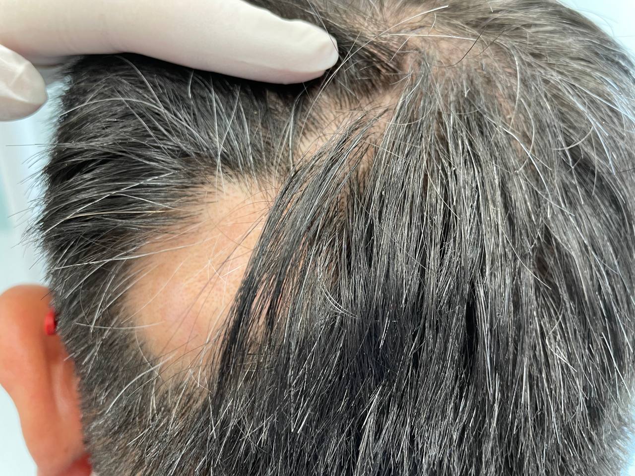 Hair Loss - DrWeil.com