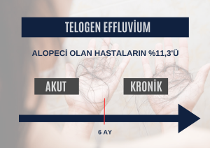 Telogen Effluvium Saç Dökülmesi, Telogen Effluvium Saç Dökülmesi Tedavisi Ankara