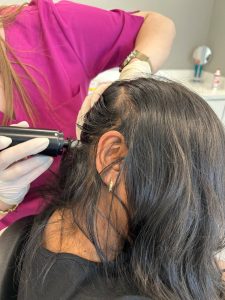 Tricopat saç dökülmesi tedavisi Ankara