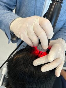 Tricopat saç dökülmesi tedavisi, saç dökülmesi tedavisi, Genetik saç dökülmesi tedavisi